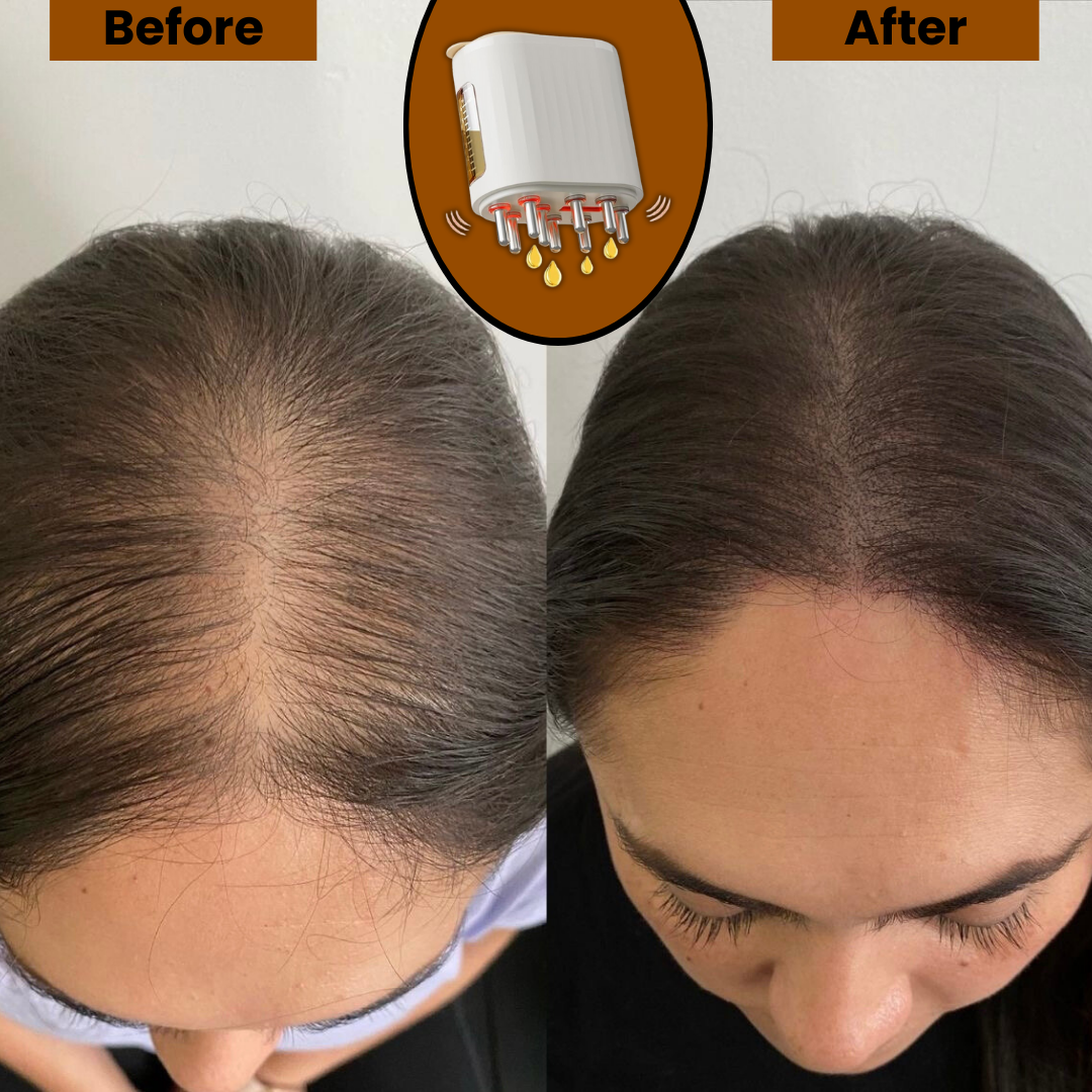 LUSHAIR ™ - Enhances Hair Growth & Scalp Health